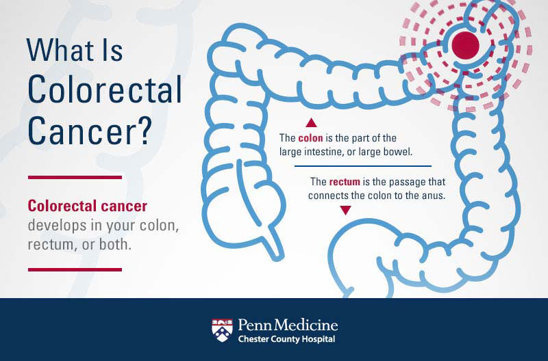 March Is National Colorectal Cancer Awareness Month - Chester County ...