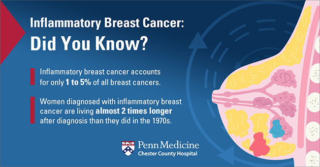 Inflammatory Breast Cancer Rash
