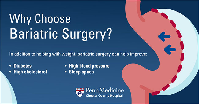 What To Expect After Bariatric Surgery - Chester County Hospital | Penn ...