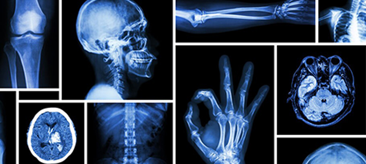 radiology images