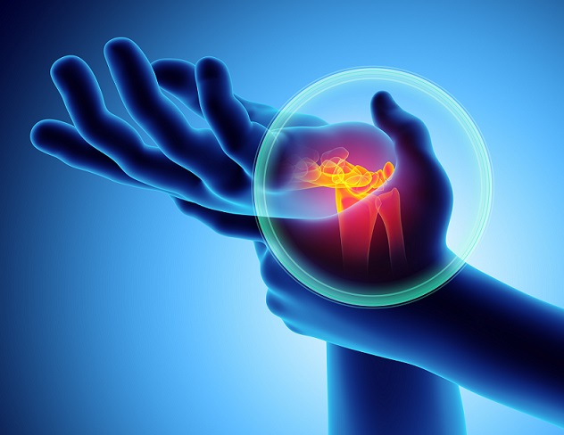 Hand or Wrist Pain? Signs to See a Doctor For Carpal Tunnel Syndrome